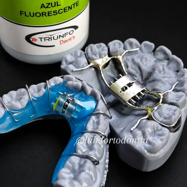 Expansor metálico com parafuso central adaptado a modelo impresso, ao lado de placa removível azul com parafuso